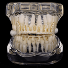 18k Gold Diamond Drip Grillz - Drip Culture Jewelry