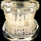 18K Gold Diamond Fire Emoji Grillz - Drip Culture Jewelry
