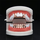 18K Gold 2 Top 6 Bottom Grillz Set - Drip Culture Jewelry