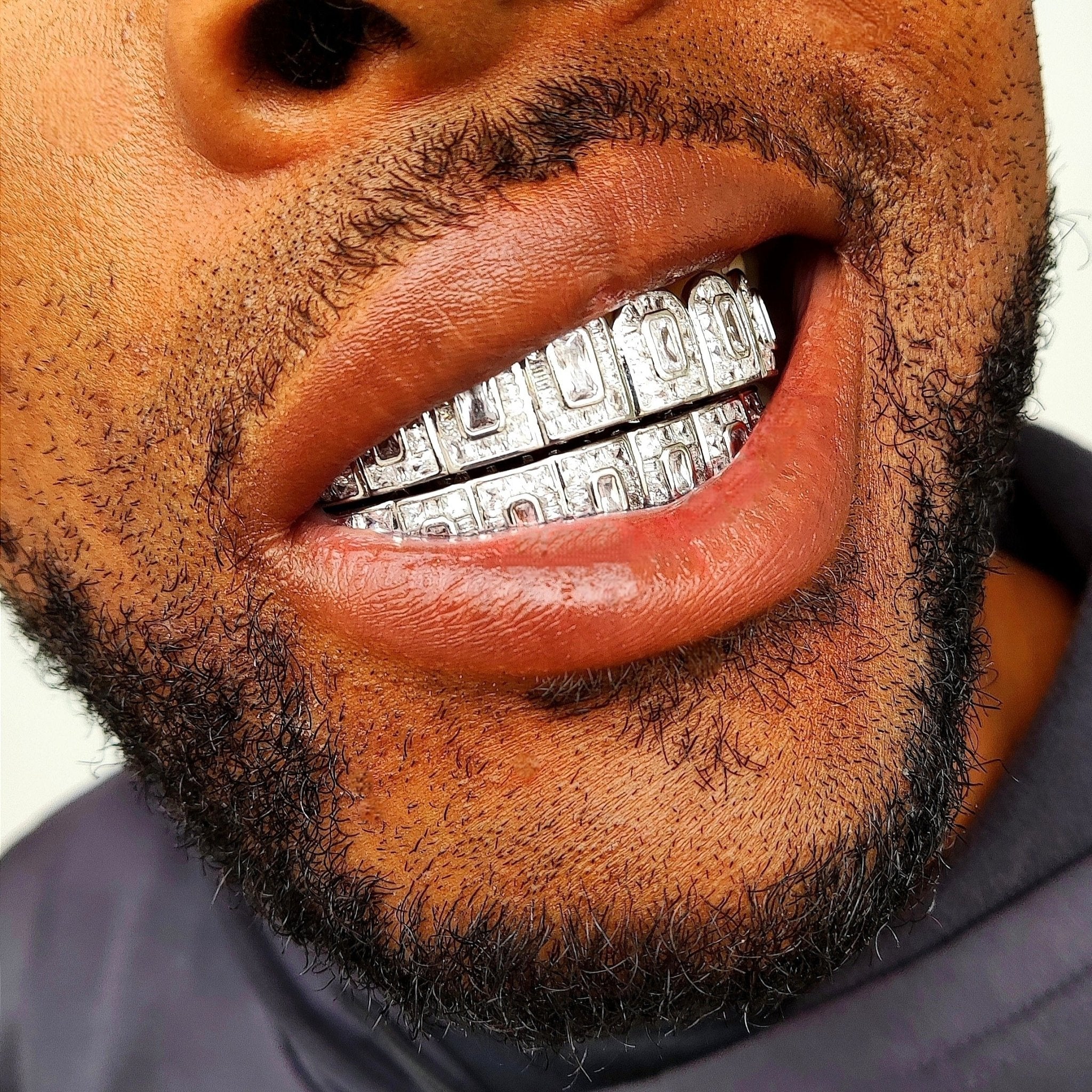 18K Gold Baguette Diamond Grillz - Drip Culture Jewelry