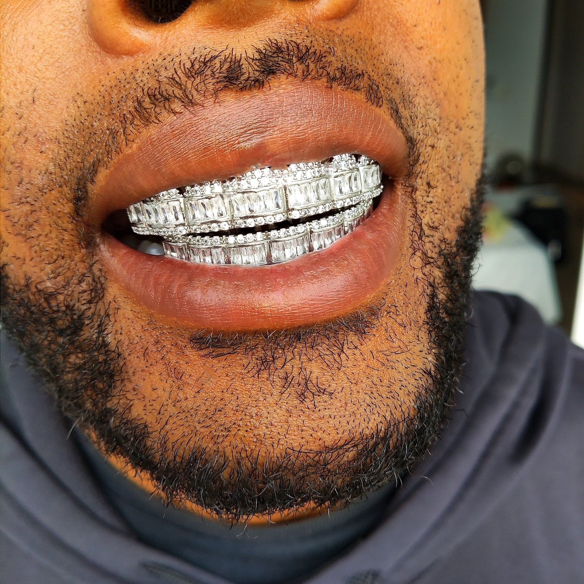 18K Gold Diamond & Baguette Grillz - Drip Culture Jewelry