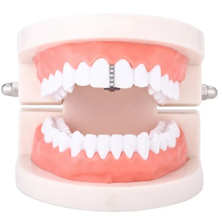 18k Gold Diamond Gap Filler Grillz - Drip Culture Jewelry