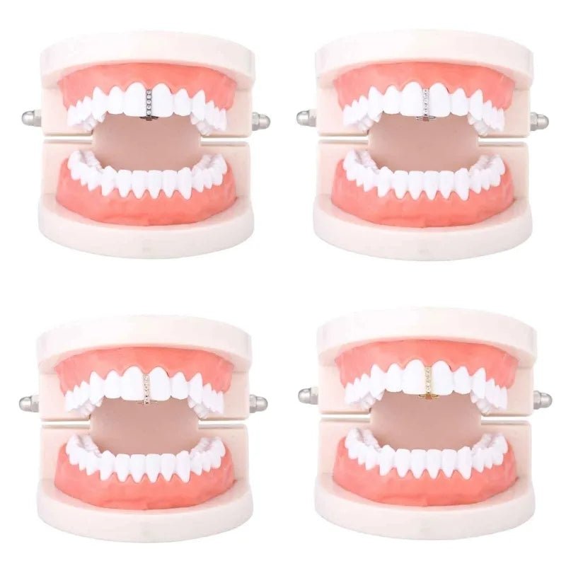 18k Gold Diamond Gap Filler Grillz - Drip Culture Jewelry