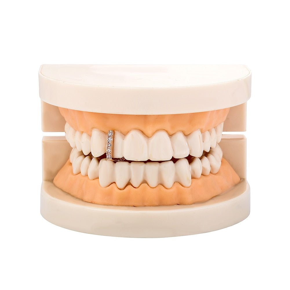 18k Gold Diamond Gap Filler Grillz - Drip Culture Jewelry