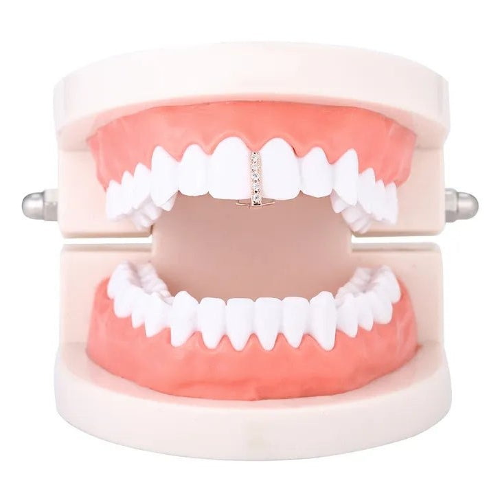 18k Gold Diamond Gap Filler Grillz - Drip Culture Jewelry