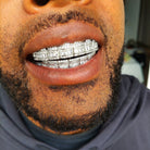 18K Gold Diamond & Baguette Grillz - Drip Culture Jewelry