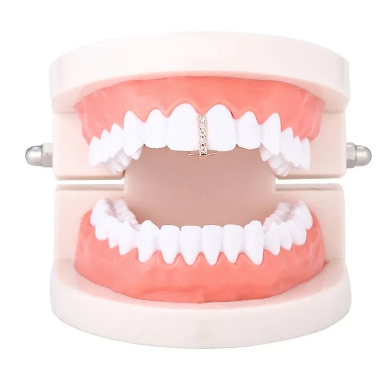 18k Gold Diamond Gap Filler Grillz - Drip Culture Jewelry