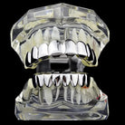 18K Gold Grillz - Drip Culture Jewelry