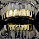 18K Gold Grillz - Drip Culture Jewelry