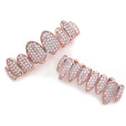 Premium 18K Gold Diamond Grill - Drip Culture Jewelry
